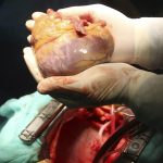 Imagen de archivo que muestra el transplante de un corazón. EFE/Salas