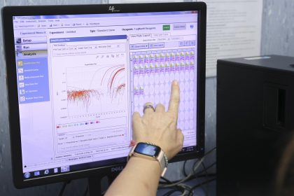 Los médicos en todo el país pueden pedir a partir de hoy la llamada prueba de orthopoxivirus a los Laboratorios de la Clínica Mayo tal como lo hacen para ordenar otros exámenes. Imagen de archivo. EFE/Kiko Huesca