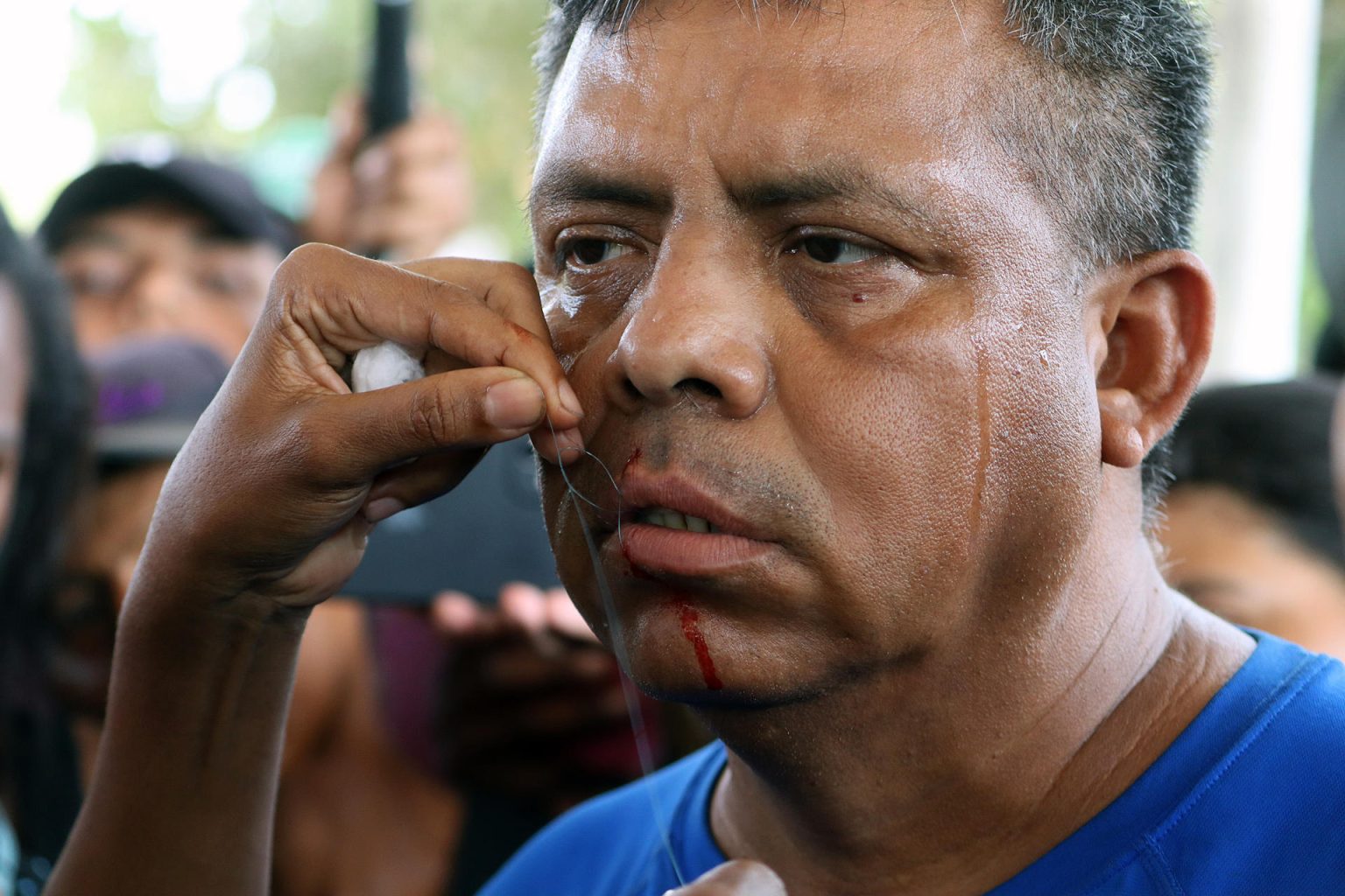 Migrantes se cosen hoy la boca mientras participan en una protesta en la ciudad de Huixtla, estado de Chiapas (México). EFE/Juan Manuel Blanco