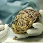 Fotografía de archivo de un médico mientras analiza un cerebro humano. EFE/Fernando Alvarado