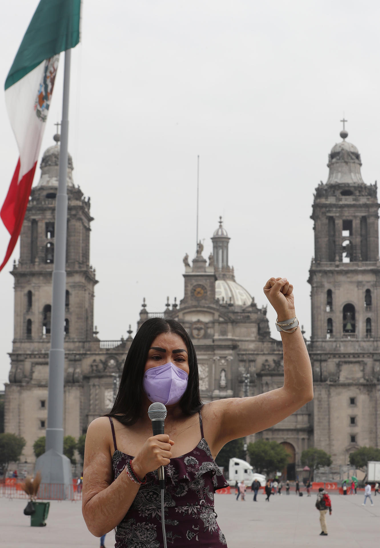 La saxofonista mexicana María Elena Ríos, victima de un ataque con ácido, habla durante una rueda de prensa este lunes, en el Zócalo de Ciudad de México (México). EFE/Mario Guzmán
